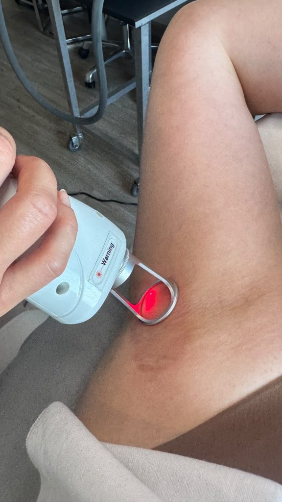 Laser Er-Glass erbowo-szklany